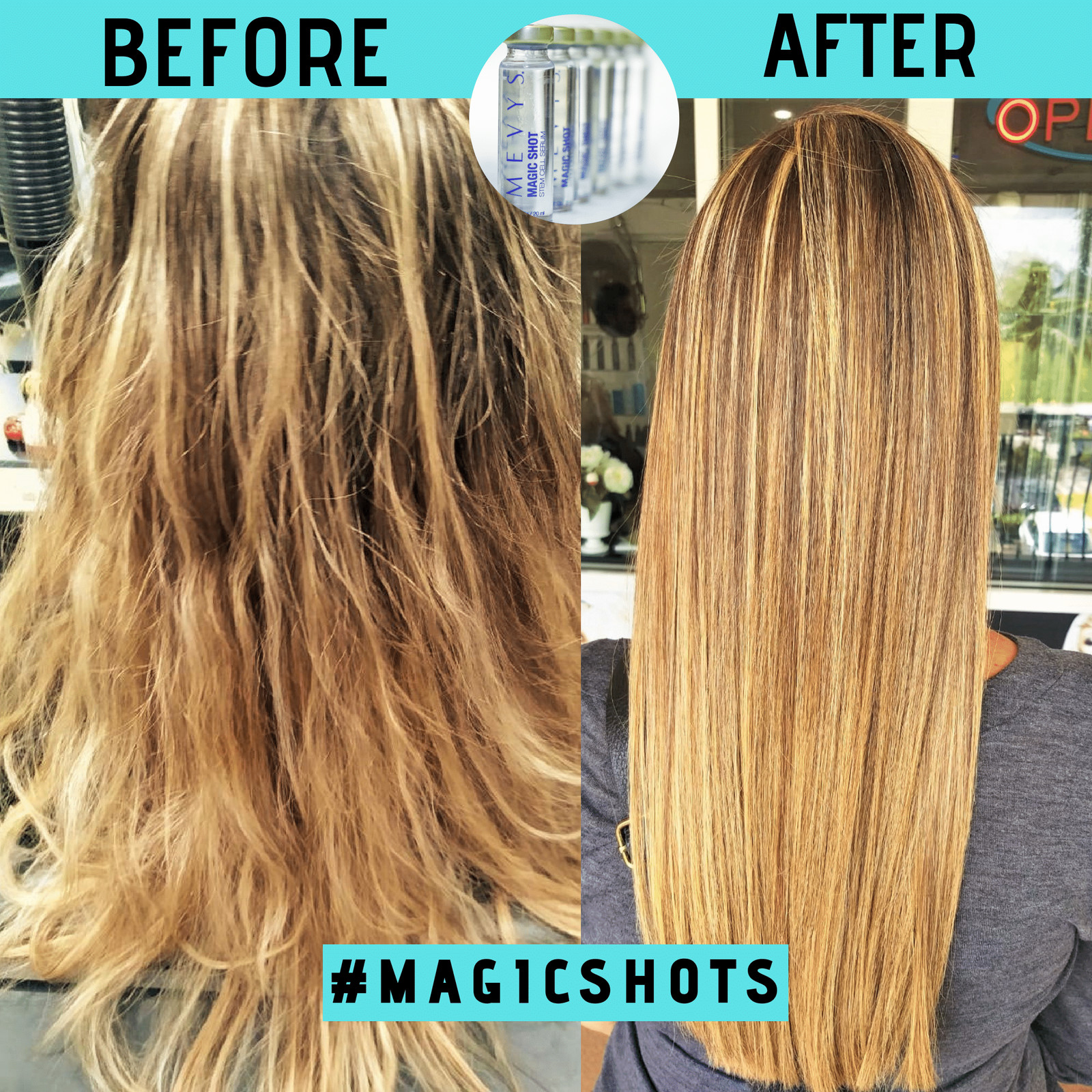Mevys Magic Shot Apple Stem Cell Serum For Hair 0.66 oz / 20 ml – Box of 6 Vials