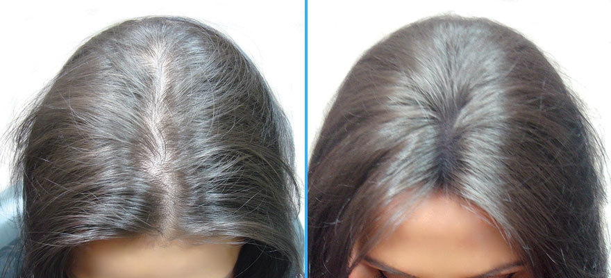 SureThik Natural Hair Building Fiber For Men & Women Thinning Hair, 27-30 Gram