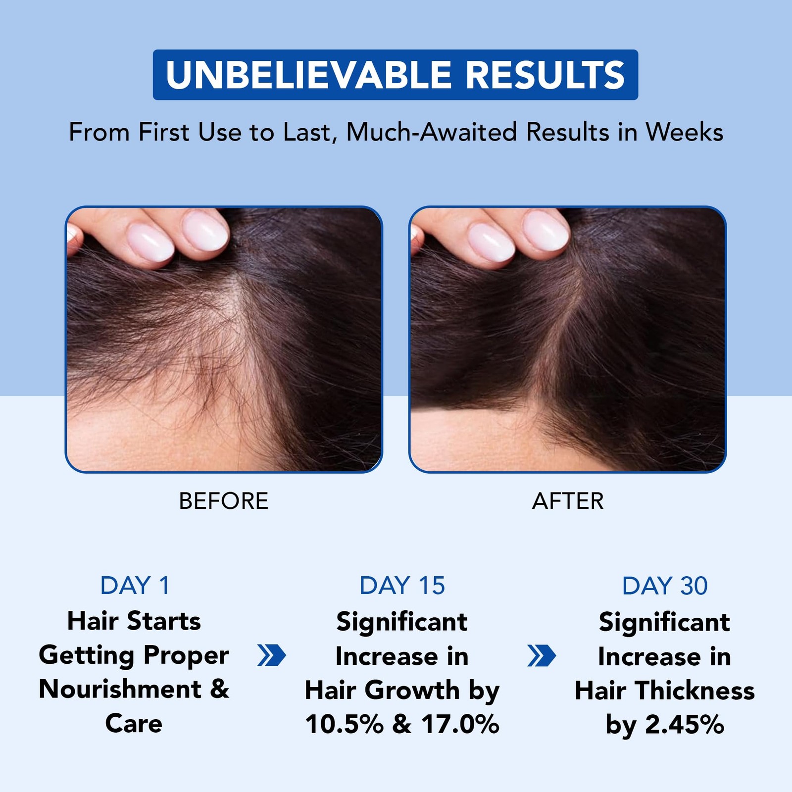 100% Pure Rosemary Oil For Hair Growth (6.7 fl oz)| Infused with Biotin, Jojoba