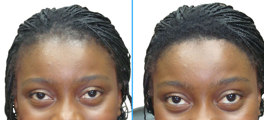 SureThik Natural Hair Building Fiber For Men & Women Thinning Hair, 27-30 Gram